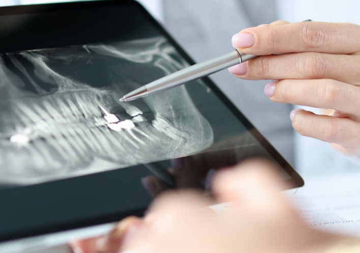 事前シミュレーションの徹底