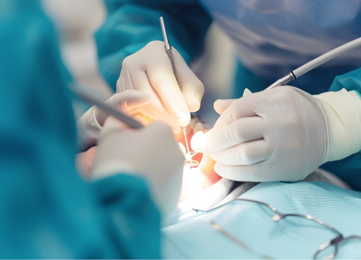 インプラント治療