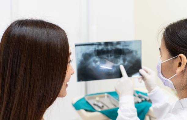 CT撮影＋シミュレーション