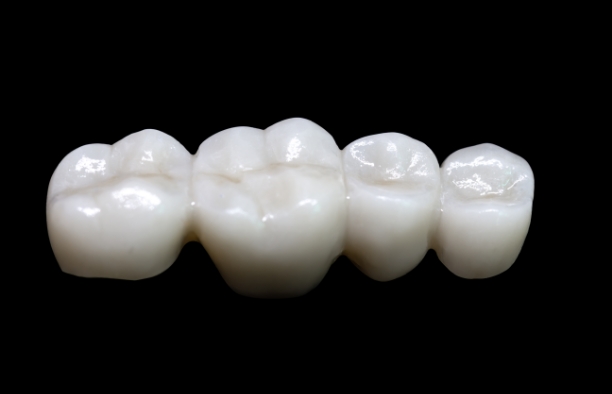 ジルコニア(白い色)